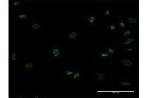 Immunofluorescence of monoclonal antibody to MEOX1 on HeLa cell. (MEOX1 antibody  (AA 82-170))