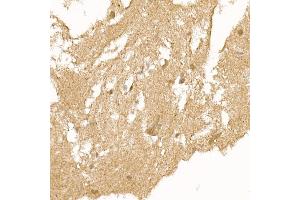Immunohistochemistry of paraffin-embedded human brain using RC Rabbit pAb (ABIN6129452, ABIN6146811, ABIN6146812 and ABIN6220955) at dilution of 1:150 (40x lens). (RCAN1 antibody  (AA 60-245))