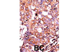 Immunohistochemistry (IHC) image for anti-LPR1 (pSer4520) antibody (ABIN3001761) (LPR1 (pSer4520) antibody)