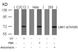 Western blot analysis of extracts from UV-treated C2C12, PMA-treated Hela and anisomycin-treated 293 cells using LIMK1(Phospho-Thr508) Antibody. (LIM Domain Kinase 1 antibody  (pThr508))