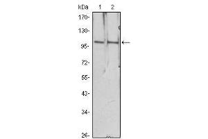 Western Blot showing HDAC4 antibody used against Hela (1), Jurkat (2) cell lysate. (HDAC4 antibody)