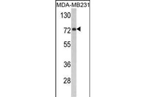 Western blot analysis of FMO3 Antibody (N-term) (ABIN390888 and ABIN2841098) in MDA-M cell line lysates (35 μg/lane). (FMO3 antibody  (N-Term))