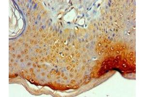 Immunohistochemistry of paraffin-embedded human skin tissue using ABIN7156454 at dilution of 1:100 (ITGA9 antibody  (AA 30-250))