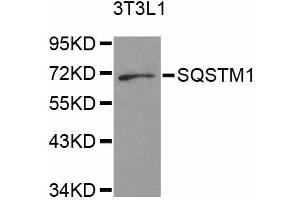 Western blot analysis of extracts of 3T3-L1 cells, using SQSTM1 antibody.