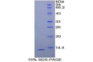 SDS-PAGE analysis of Human uPAR Protein.