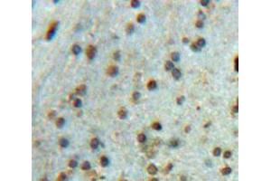 Used in DAB staining on fromalin fixed paraffin-embedded brain tissue (SRPK2 antibody  (AA 380-617))