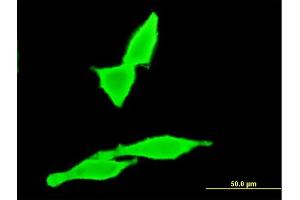 Immunofluorescence of monoclonal antibody to CNR2 on HeLa cell. (CNR2 antibody  (AA 302-360))