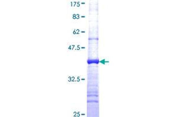 NDUFS3 Protein (AA 155-264) (GST tag)