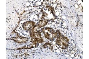 IHC analysis of VPRBP/DCAF1 using anti-VPRBP/DCAF1 antibody (ABIN7599063). (DDB1 and CUL4-Associated Factor 1 (DCAF1) (AA 1-195) antibody)