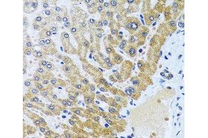 Immunohistochemistry of paraffin-embedded Human liver using CPA6 Polyclonal Antibody at dilution of 1:100 (40x lens). (CPA6 antibody)