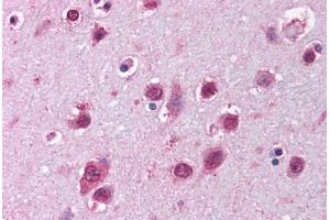 Human Brain, Cortex (formalin-fixed, paraffin-embedded) stained with SOX12 antibody ABIN214148 at 5 ug/ml followed by biotinylated goat anti-rabbit IgG secondary antibody ABIN481713, alkaline phosphatase-streptavidin and chromogen. (SOX12 antibody  (C-Term))