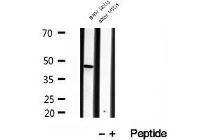 Western blot analysis of extracts of mouse testis tissue, using BBS5 antibody. (BBS5 antibody  (C-Term))