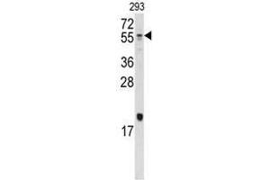 Image no. 1 for anti-Bone Morphogenetic Protein 10 (BMP10) (N-Term) antibody (ABIN357176) (BMP10 antibody  (N-Term))