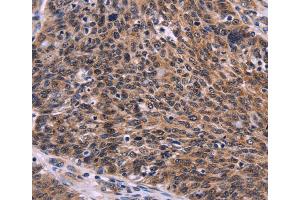 Immunohistochemistry (IHC) image for anti-CDC5 Cell Division Cycle 5-Like (S. Pombe) (CDC5L) antibody (ABIN2429464) (CDC5L antibody)
