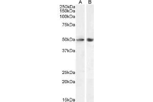 ABIN6391389 (0. (SOX10 antibody  (AA 204-217))