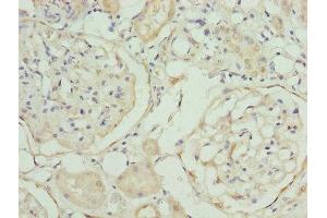 Immunohistochemistry of paraffin-embedded human kidney tissue using ABIN7168530 at dilution of 1:100 (MAT2A antibody  (AA 1-395))