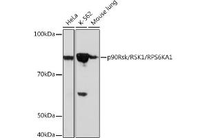 Western blot analysis of extracts of various cell lines, using p90Rsk/RSK1/RPS6K Rabbit mAb (ABIN1681116, ABIN3019149, ABIN3019150 and ABIN7101723) at 1:1000 dilution. (RPS6KA1 antibody)