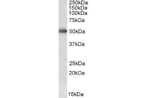 Western Blotting (WB) image for anti-Cytochrome P450, Family 2, Subfamily E, Polypeptide 1 (CYP2E1) antibody (ABIN5898171) (CYP2E1 antibody)