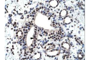 Image no. 1 for anti-Zinc Finger and BTB Domain Containing 45 (ZBTB45) (AA 200-249) antibody (ABIN6735917) (ZBTB45 antibody  (AA 200-249))