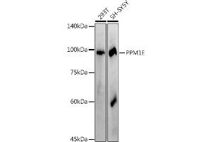 Western blot analysis of extracts of various cell lines, using (ABIN7269695) at 1:1000 dilution. (PPM1E antibody)