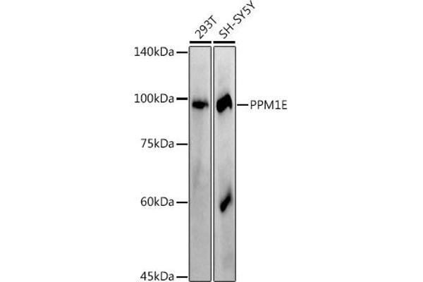 PPM1E antibody