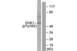 Western blot analysis of extracts from 293 cells, using p62 Dok (Phospho-Tyr362) Antibody.