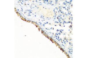 Immunohistochemistry of paraffin-embedded mouse lung using CBL antibody at dilution of 1:200 (40x lens).