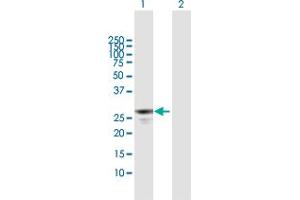 Western Blot analysis of APOBEC2 expression in transfected 293T cell line by APOBEC2 MaxPab polyclonal antibody. (APOBEC2 antibody  (AA 1-224))