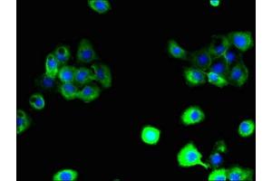 Immunofluorescent analysis of A431 cells using ABIN7164606 at dilution of 1:100 and Alexa Fluor 488-congugated AffiniPure Goat Anti-Rabbit IgG(H+L) (SLC38A6 antibody  (AA 132-169))