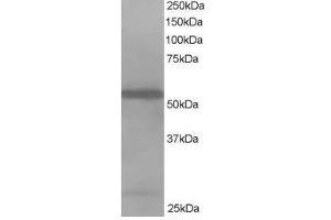 Image no. 1 for anti-Drebrin-Like (DBNL) (N-Term) antibody (ABIN374214) (DBNL antibody  (N-Term))