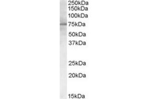 Image no. 3 for anti-Proprotein Convertase Subtilisin/kexin Type 9 (PCSK9) (C-Term) antibody (ABIN374535)