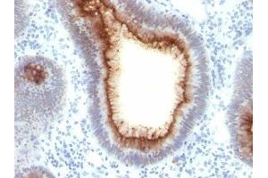 Image no. 1 for anti-Carcinoembryonic Antigen-Related Cell Adhesion Molecule 5 (CEACAM5) antibody (ABIN6151894) (CEACAM5 antibody)
