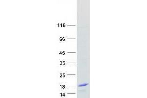 Validation with Western Blot (SNRPG Protein (Myc-DYKDDDDK Tag))