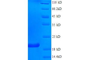 SDS-PAGE (SDS) image for Fragile Histidine Triad (FHIT) (AA 2-147) protein (His tag) (ABIN4975956) (FHIT Protein (AA 2-147) (His tag))
