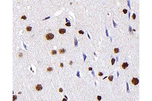 Immunohistochemistry analysis of paraffin-embedded Rat brain using S100A4 Monoclonal Antibody at dilution of 1:300. (s100a4 antibody)