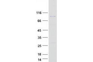 ACAD11 Protein (Myc-DYKDDDDK Tag)