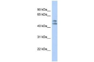 PAFAH1B1 antibody used at 1 ug/ml to detect target protein. (PAFAH1B1 antibody  (N-Term))