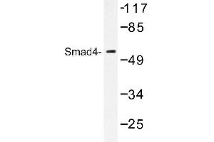 Image no. 1 for anti-SMAD Family Member 4 (SMAD4) antibody (ABIN272224) (SMAD4 antibody)