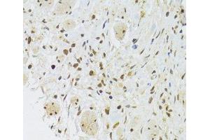 Immunohistochemistry (Paraffin-embedded Sections) (IHC (p)) image for anti-Elongation Factor Tu GTP Binding Domain Containing 2 (EFTUD2) antibody (ABIN7262991)