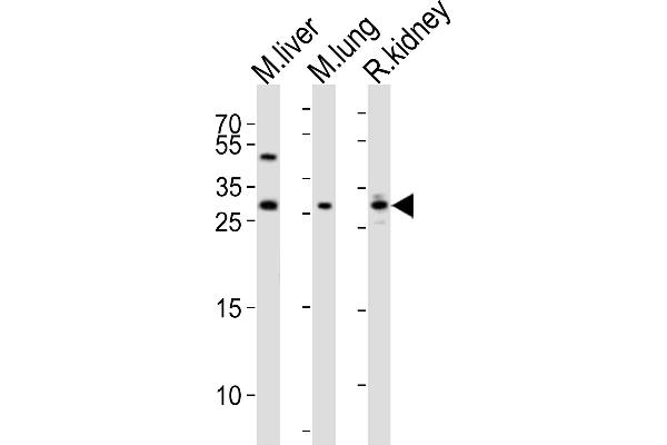 Sclerostin antibody  (N-Term)