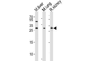 Western blot analysis of lysates from mouse liver, mouse lung, rat kidney tissue lysate (from left to right), using SOST Antibody (N-term) (ABIN390193 and ABIN2840682).