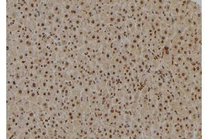 ABIN6277020 at 1/100 staining Mouse liver tissue by IHC-P. (TAF9 antibody  (Internal Region))