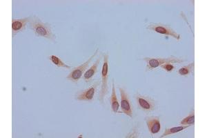 Immunocytochemistry analysis of Hela cells using ABIN7139184 at dilution of 1:100 (HIST1H2BB antibody  (acLys5))
