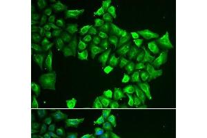 Immunofluorescence analysis of HeLa cells using ASL Polyclonal Antibody (ASL antibody)