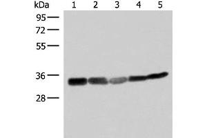 Western blot analysis of 293T HepG2 and A549 cell lysates using ECH1 Polyclonal Antibody at dilution of 1:200