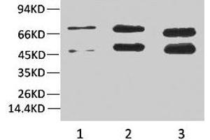 Western blot analysis of 1) Hela, 2)Rat Brain Tissue, 3) Mouse Brain Tissue with Phosphoserine Mouse mAb diluted at 1:2000. (Phosphoserine antibody)