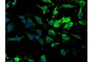 Immunofluorescence staining of U251 cells with ABIN7143283 at 1:160,counter-stained with DAPI. (ADA antibody  (AA 157-343))