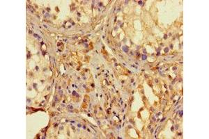 Immunohistochemistry of paraffin-embedded human testis tissue using ABIN7142130 at dilution of 1:100