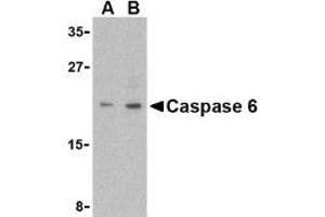Western blot analysis of Caspase-6 in MCF7 cell lysate with AP30201PU-N Caspase-6 antibody (IN) at (A) 1 and (B) 2 μg/ml. (Caspase 6 antibody  (Intermediate Domain))