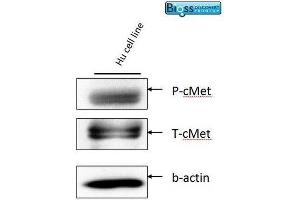 Image was kindly submitted by An anonymous end user. (c-MET antibody  (pTyr1234, pTyr1235))